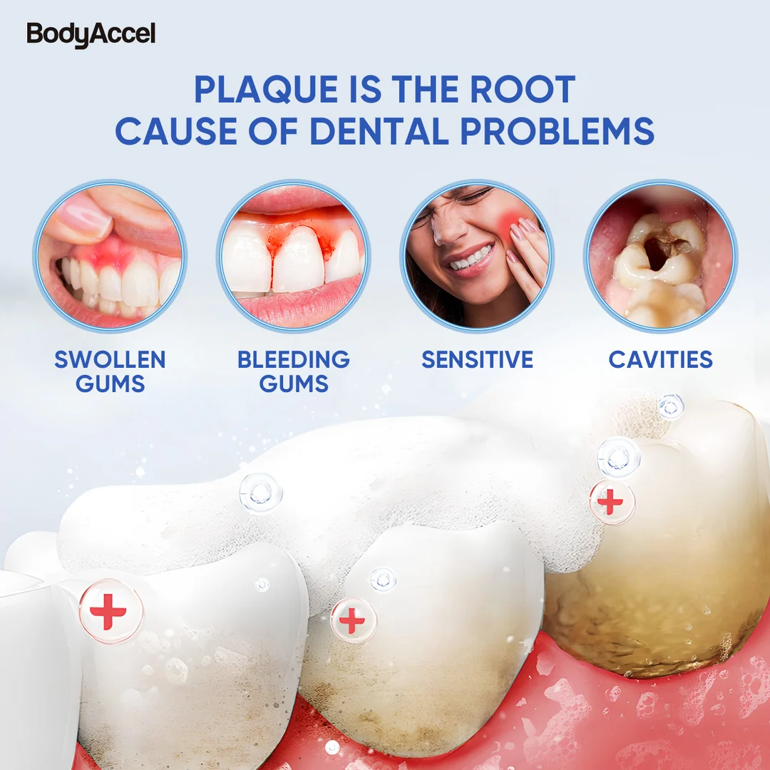 Plaque-related dental problems: swollen gums, bleeding gums, sensitivity and cavities