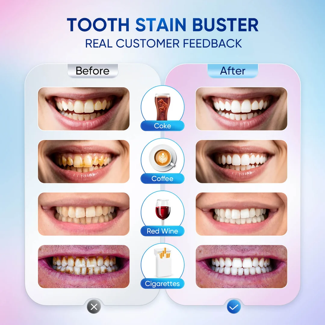 Before and after: teeth stained by coke, coffee, red wine and cigarettes