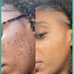 darkspots
